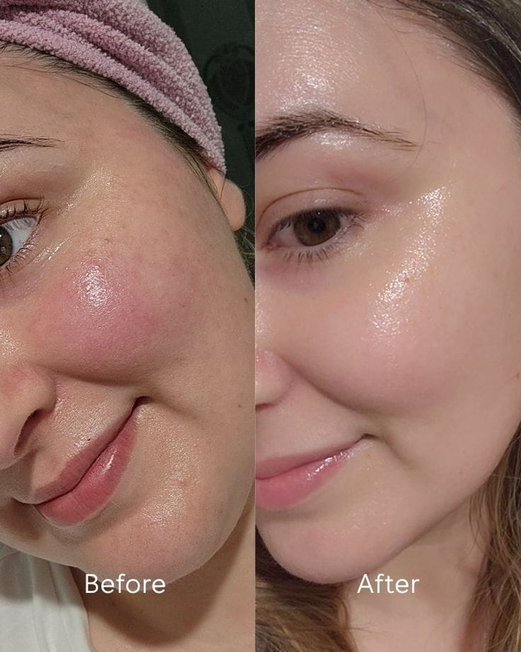 Face, Hand & Body Whitening Cream